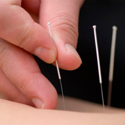 Стерильные иглы для акупунктуры 0,25 х 25 (1000 шт.) SAN-25-25-1000, фото №4